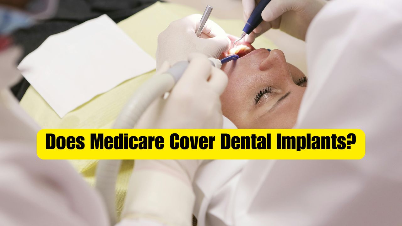 Does Medicare Cover Dental Implants?